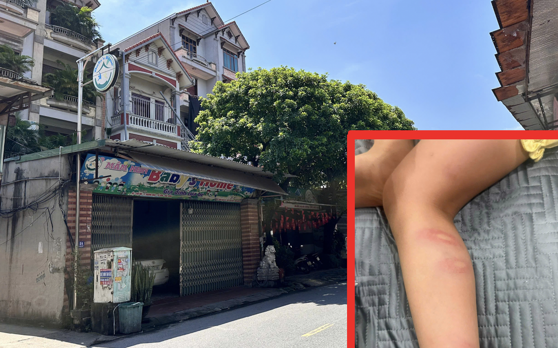 Vụ bé 5 tuổi bị cô giáo "tác động vật lý": Phường kiểm tra toàn diện, gia đình xin chuyển trường