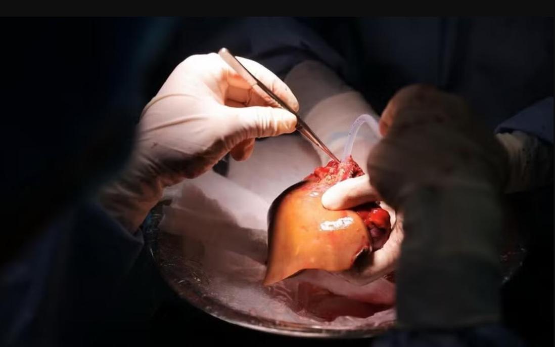 Bỉ tìm ra hướng đi mới trong điều trị ung thư gan di căn