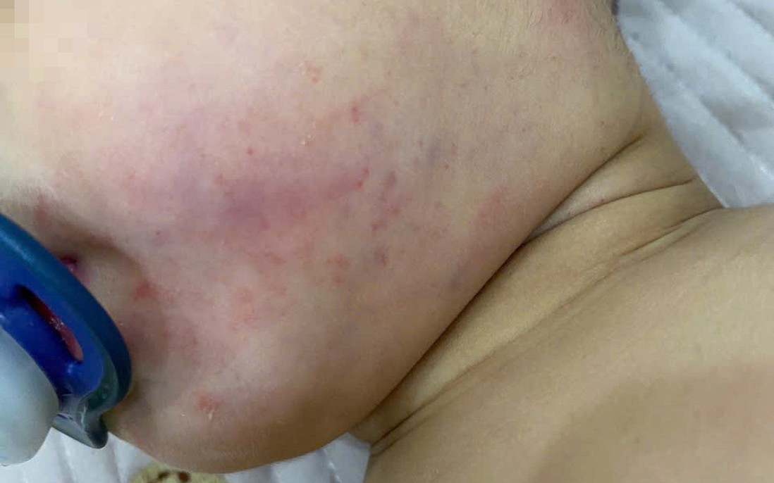Công an Hà Nội tiếp nhận tố giác việc bé 2 tuổi bị tổn thương sau buổi học tại trung tâm Little Star
