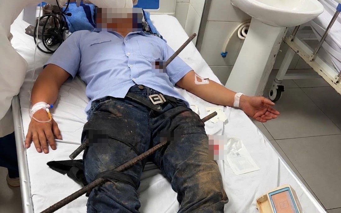 Kịp thời cứu bệnh nhân bị hai thanh sắt xuyên đùi và bụng