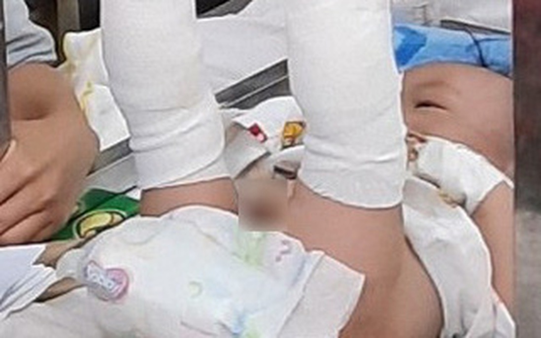 Người cha nhận tội đánh con trai 4 tháng tuổi khiến bé gãy chân, xuất huyết não