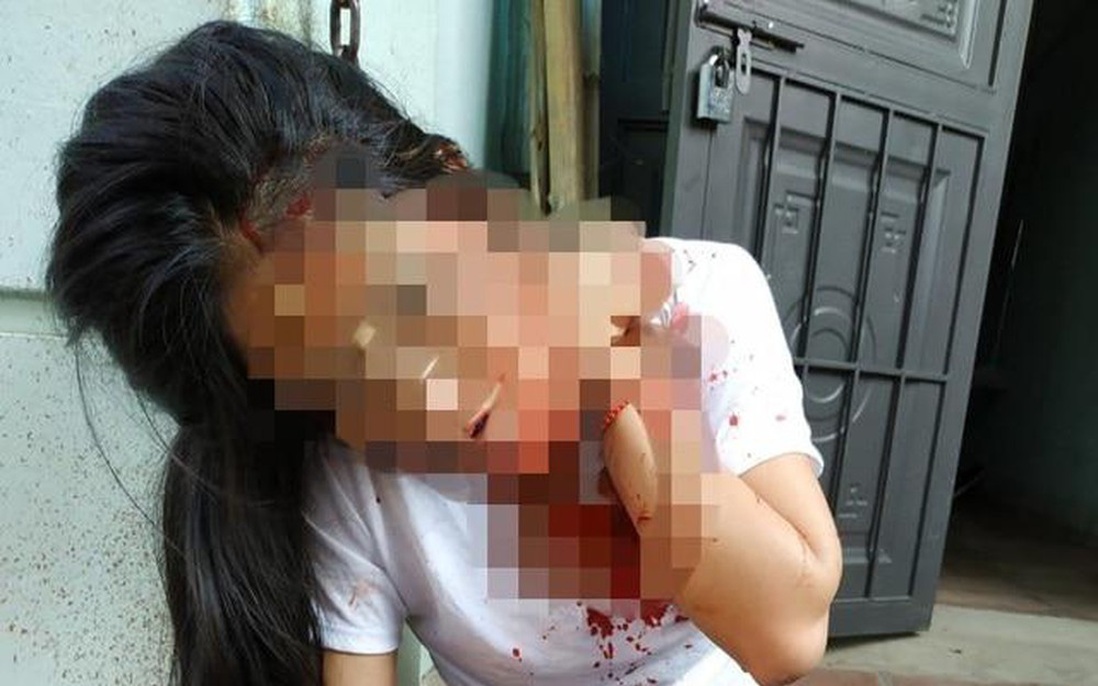 Cô gái bị chồng hờ của mẹ đánh nhập viện, Hội LHPN Thanh Hóa lên tiếng