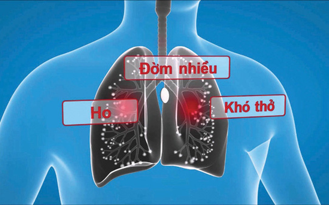 5 biến chứng của viêm phế quản mãn tính cực kỳ nguy hiểm