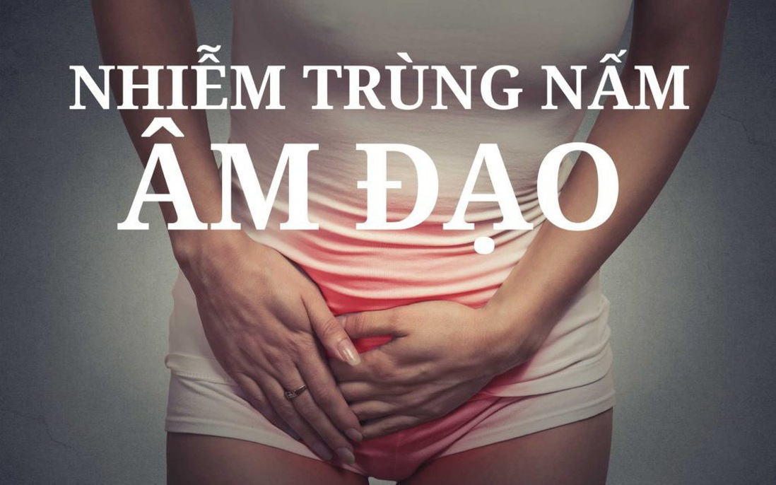 Tổng quan kiến thức về bệnh nấm âm đạo