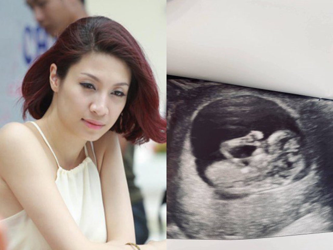 Pha Lê và nỗi đau 3 lần sảy thai, phải tự tiêm hormone  vì mong có con ở tuổi 33