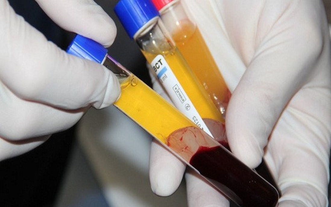 Việt Nam sẽ sớm sử dụng huyết tương trong điều trị Covid-19