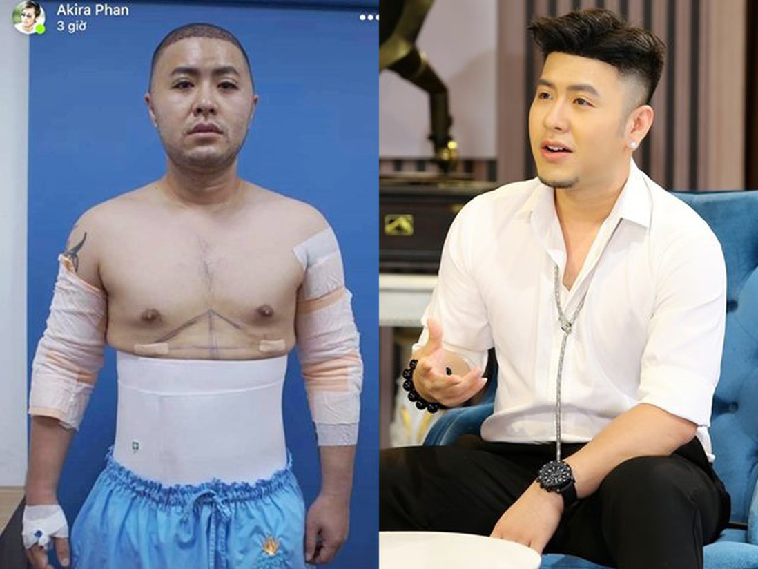 Akira Phan "bóc phốt" nhiều nam nghệ sĩ nâng ngực thành 6 múi mà không dám thừa nhận