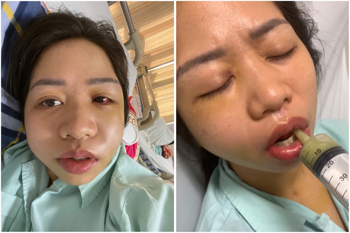 Vụ chó chạy ra đường gây tai nạn ở Lào Cai: 7 ngày Công an xã Bảo Hà ra 2 công văn trái ngược nhau- Ảnh 1.