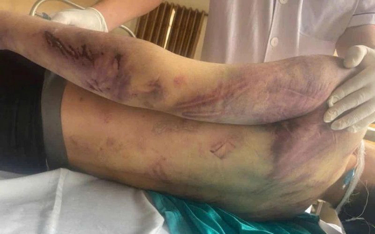 Vụ nam sinh 17 tuổi tử vong: Trung tâm xã hội ở Quảng Ninh bị tạm đình chỉ hoạt động- Ảnh 1.