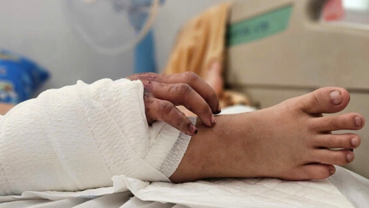 Những ca phẫu thuật gây "chấn động" của ngành Y Việt Nam năm 2025- Ảnh 1.