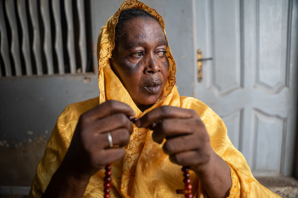 Bà Bintou, 60 tuổi, đã ngừng tẩy trắng da ngay khi thấy xuất hiện những đốm nâu trên mặt mình