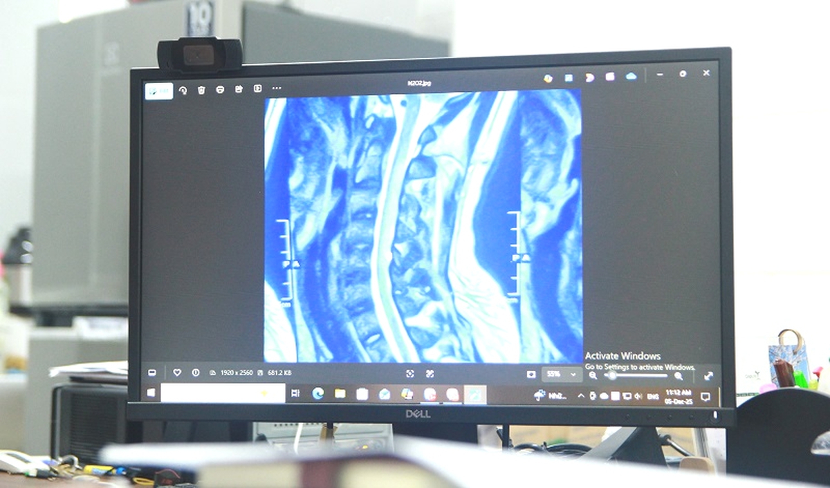 Cô gái 23 tuổi liệt tứ chi vì bóng cười- Ảnh 2.