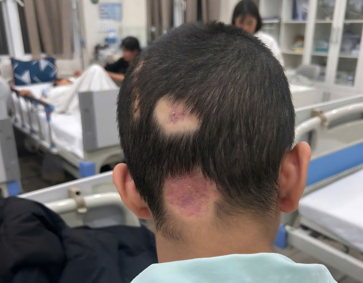 Khởi tố hành vi "Giết người" vụ nam sinh 14 tuổi ở Bắc Ninh bị đánh chấn thương sọ não- Ảnh 2.