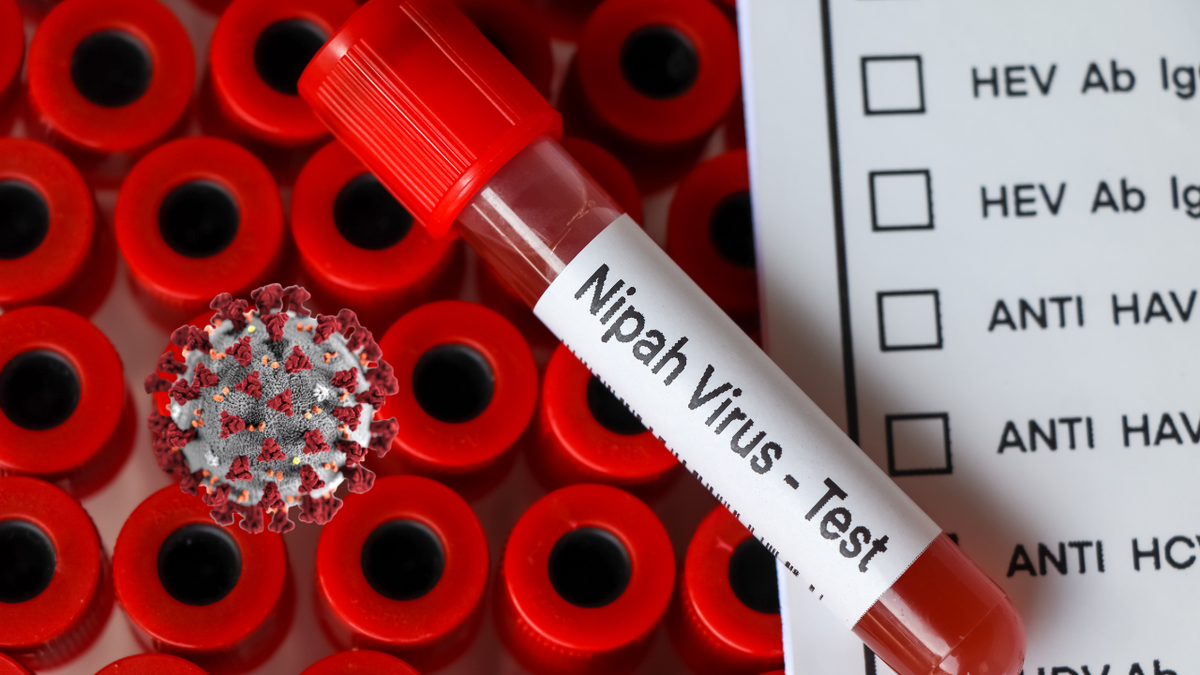 Virus Nipah: Khó bùng nổ thành đại dịch nhưng vẫn là mối đe dọa lớn- Ảnh 2.