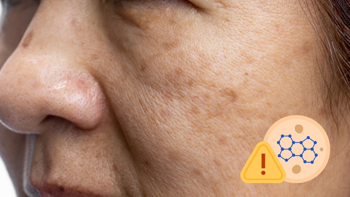 Cách điều trị sạm nám da đơn giản bằng Đông y- Ảnh 1.