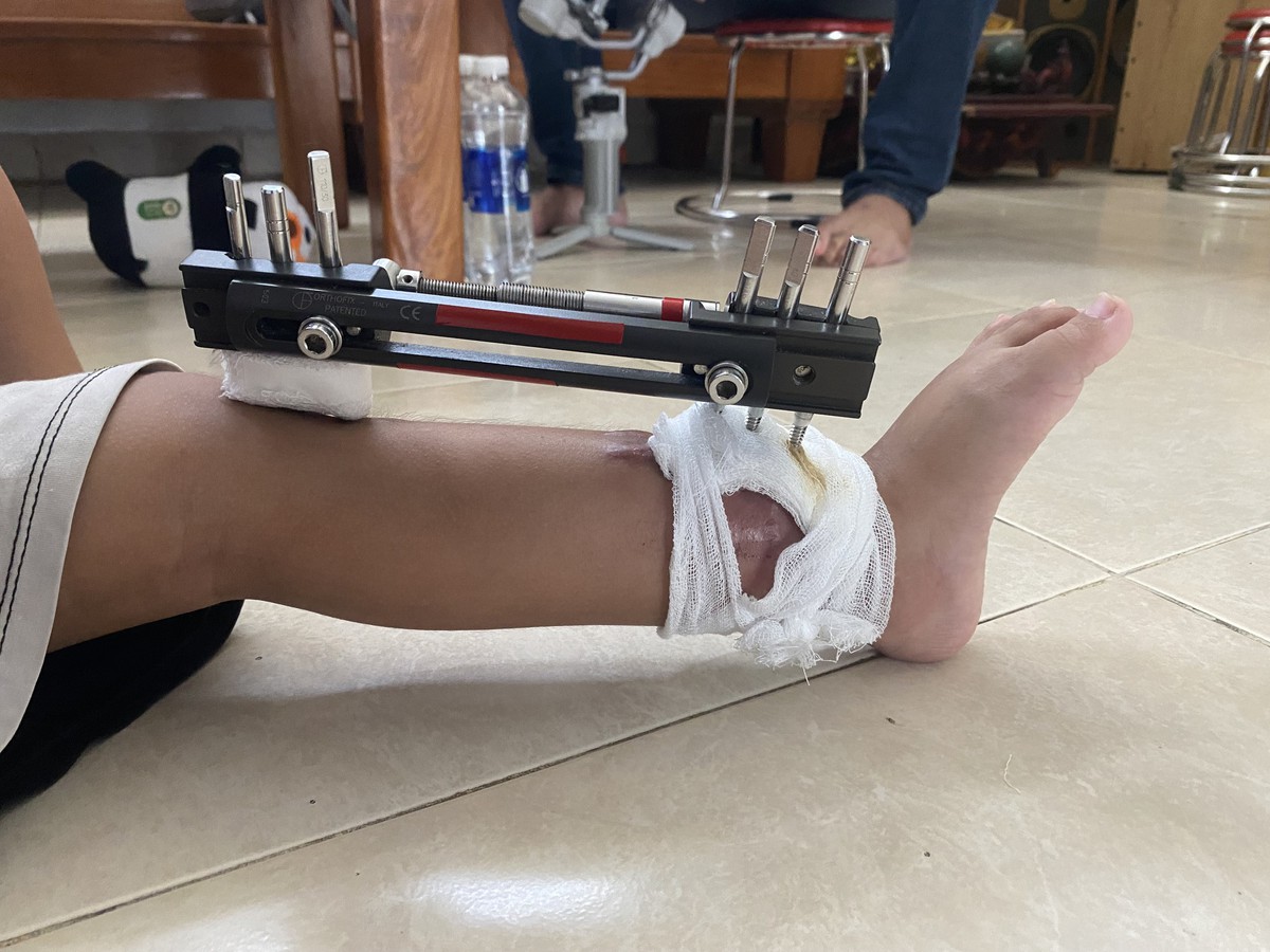 Hành trình tìm lại những bước chân cho trẻ em vùng cao- Ảnh 4.