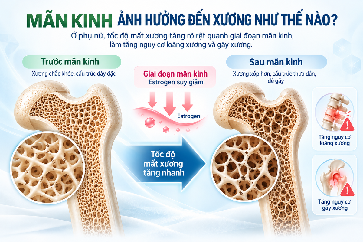 Mãn kinh: Những điều phụ nữ âm thầm chịu đựng - Ảnh 1.