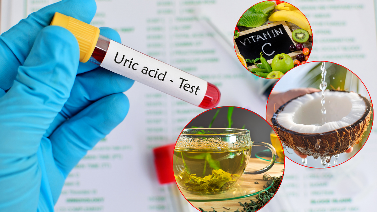 Những thực phẩm hỗ trợ đào thải axit uric sau khi uống rượu dịp Tết- Ảnh 1.