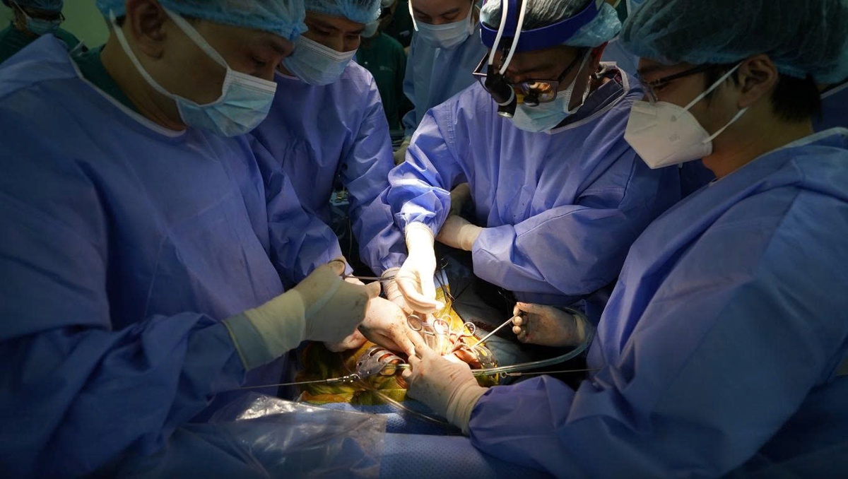 Ghép gan trẻ em mang lại cơ hội sống cho nhiều bệnh nhi từng đứng bên lằn ranh sinh - tử- Ảnh 2.