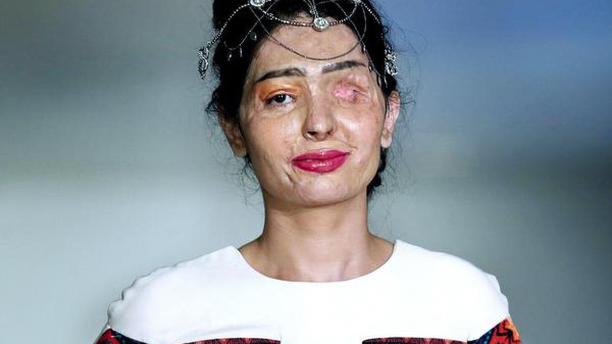 Hành trình 4 phụ nữ viết lại số phận sau khi bị tấn công bằng axit- Ảnh 4.