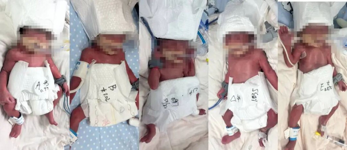 Trung Quốc: Sản phụ 24 tuổi sinh 5 hiếm gặp- Ảnh 2.