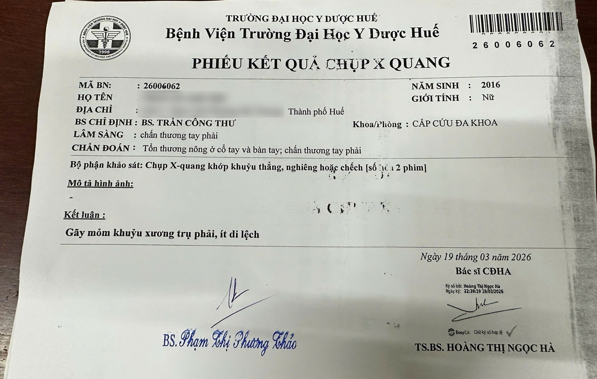 Huế: Học sinh lớp 4 bị chấn thương tay, cô giáo nhận đã 