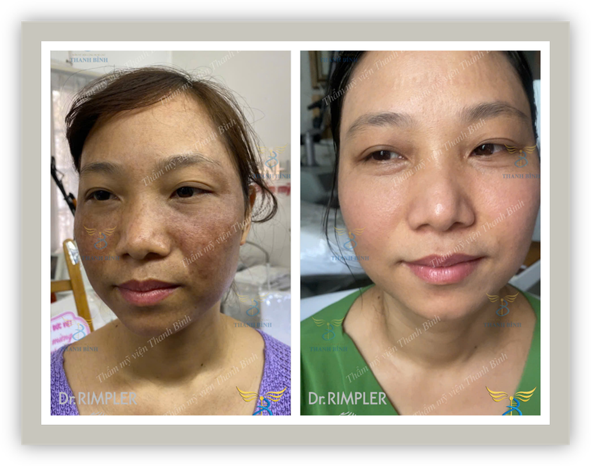 Thẩm mỹ viện Thanh Bình - Nơi nuôi dưỡng vẻ đẹp tự nhiên từ bên trong- Ảnh 2.