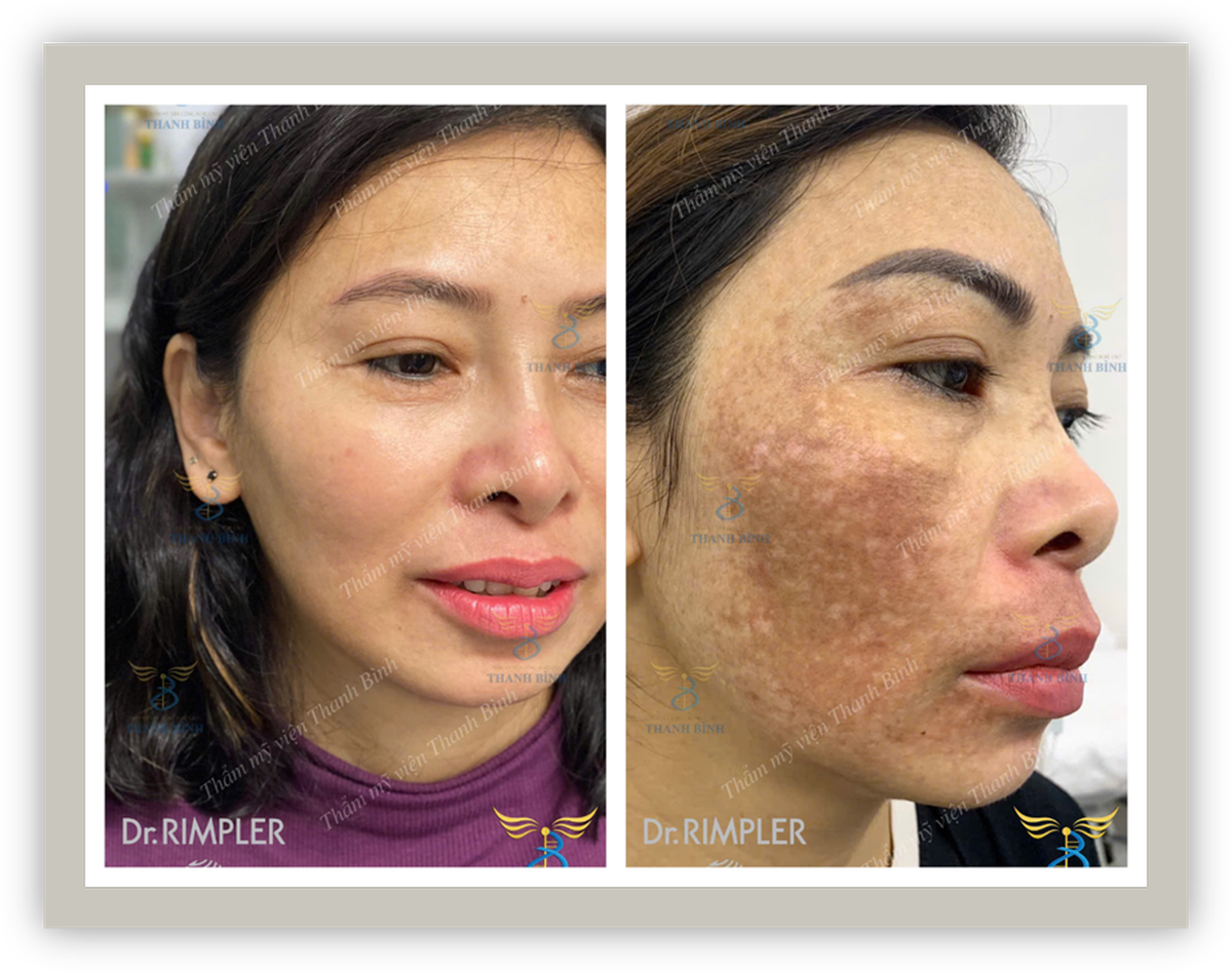 Thẩm mỹ viện Thanh Bình - Nơi nuôi dưỡng vẻ đẹp tự nhiên từ bên trong- Ảnh 3.