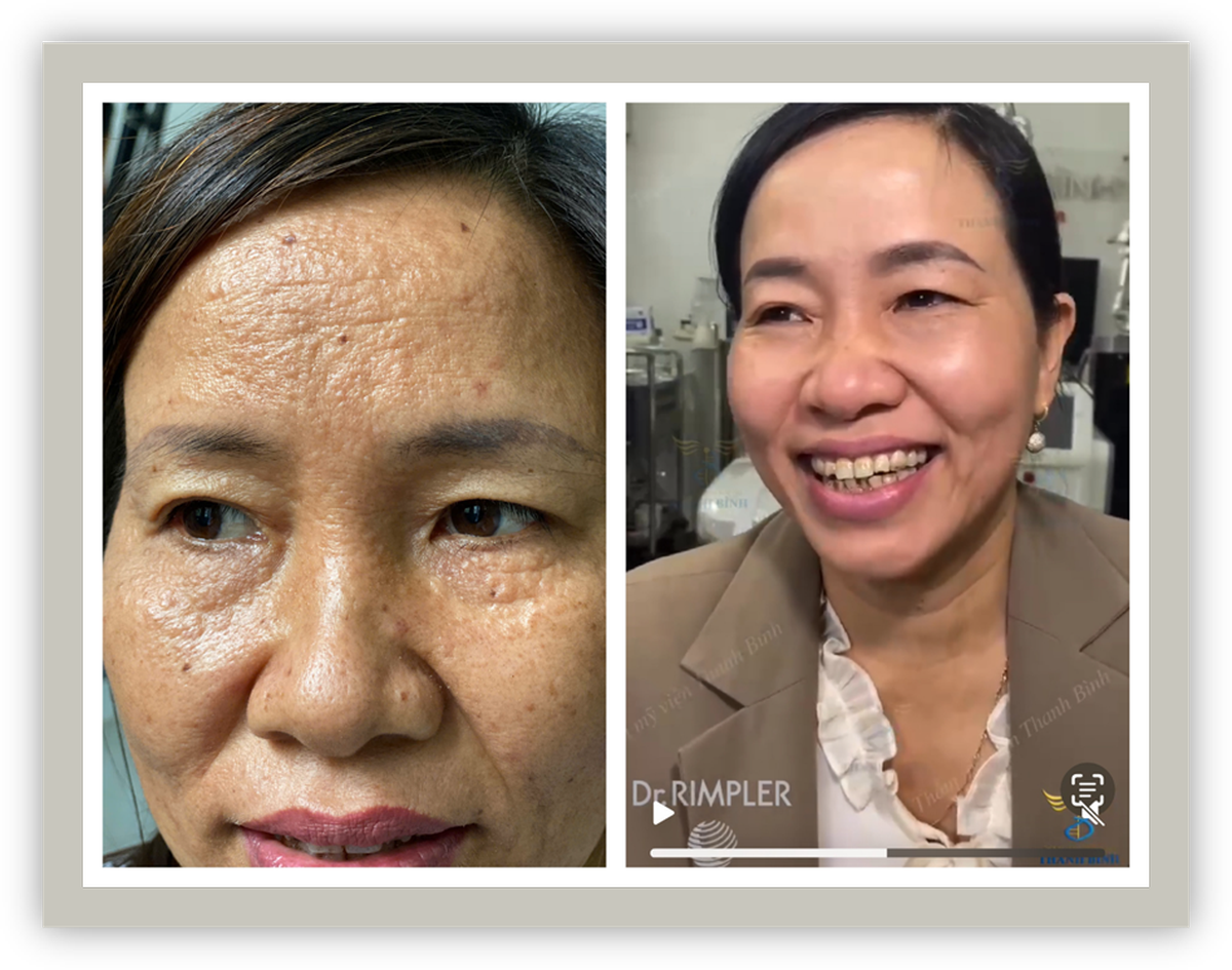 Thẩm mỹ viện Thanh Bình - Nơi nuôi dưỡng vẻ đẹp tự nhiên từ bên trong- Ảnh 4.