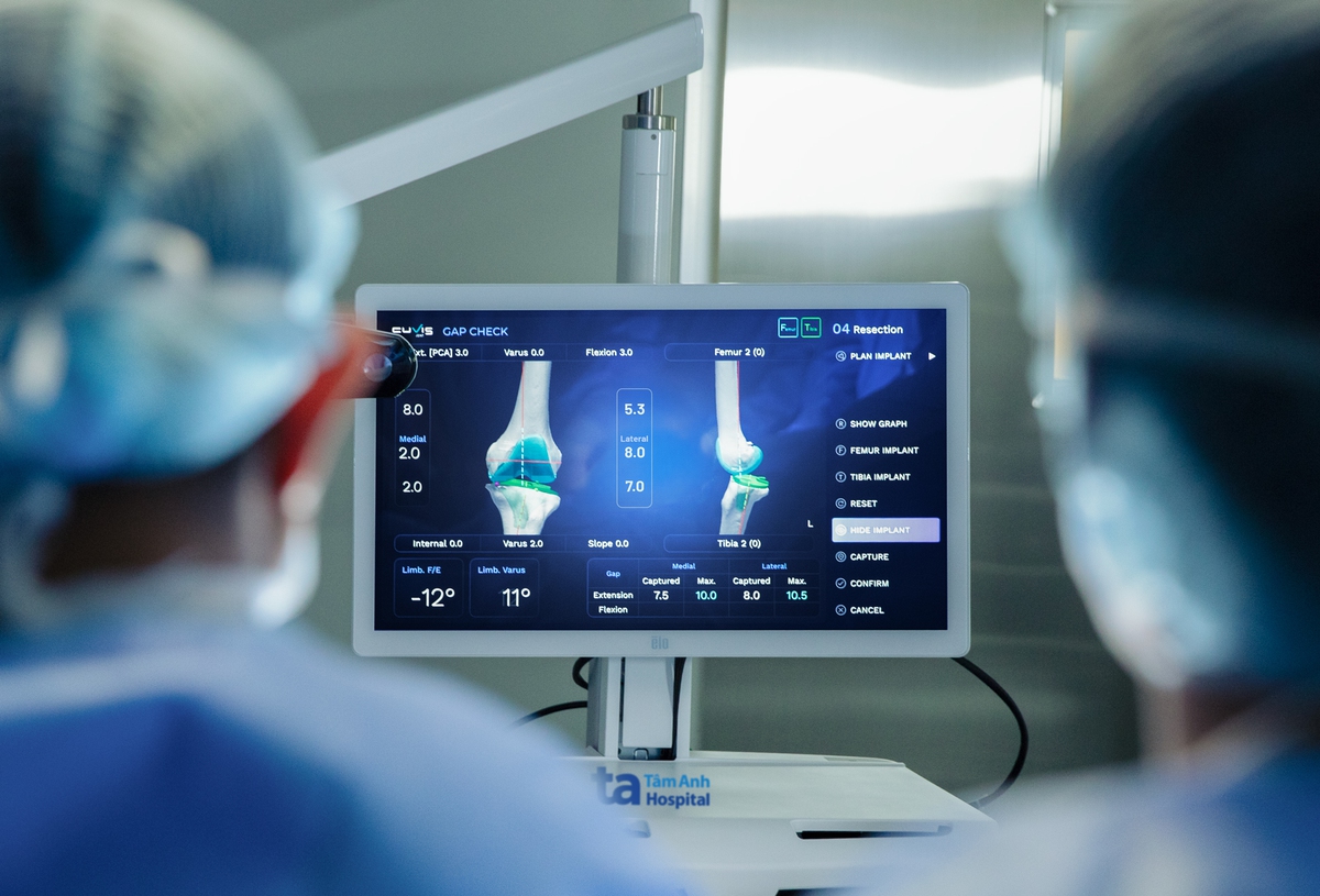 Lần đầu tiên tại Việt Nam: Thay khớp bằng Robot AI- Ảnh 1.