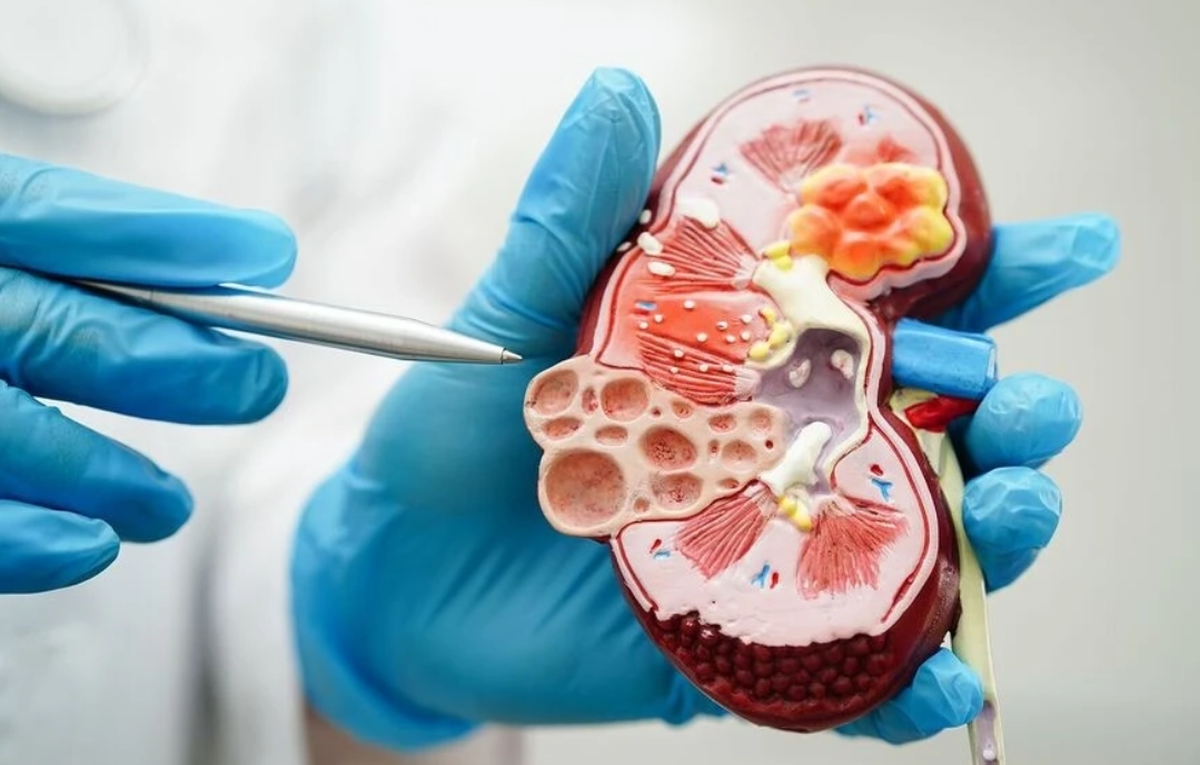 Bệnh não mô cầu gia tăng: Trẻ em chiếm gần một nửa số ca mắc- Ảnh 1.