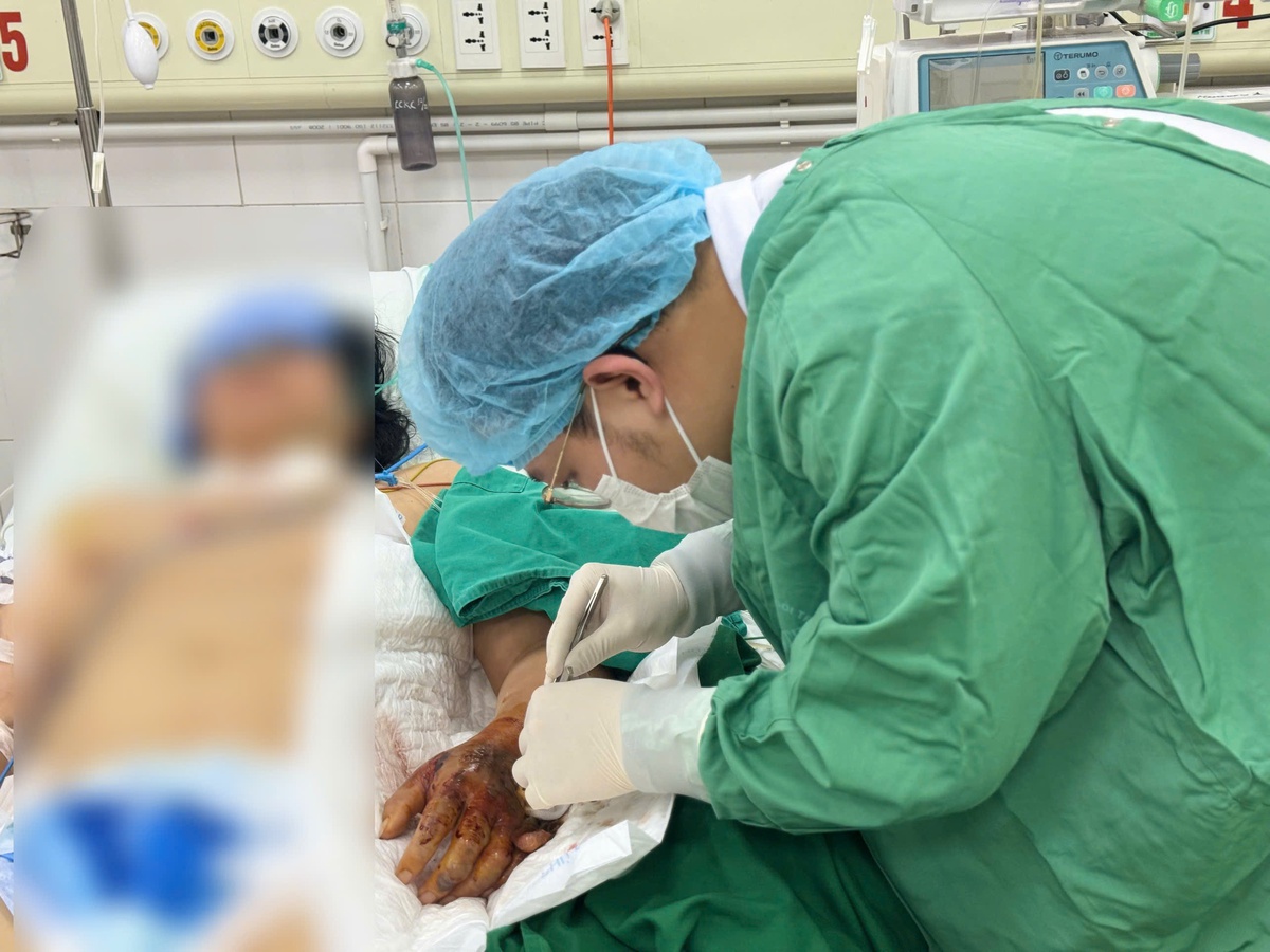 Sốc nhiễm trùng, suy đa tạng từ mũi tiêm trên da ở phòng khám tư- Ảnh 2.