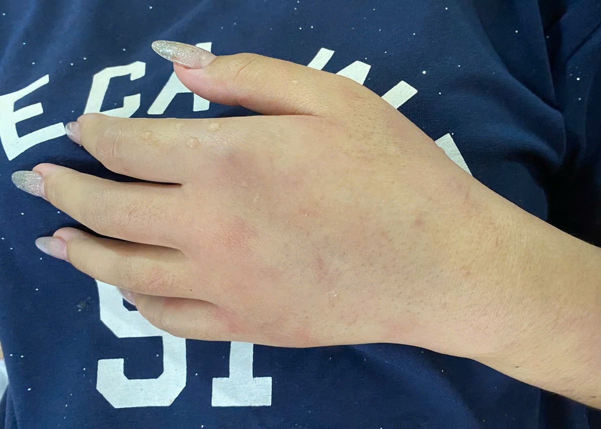 Bị ong rừng tấn công, 8 người nhập viện- Ảnh 2.