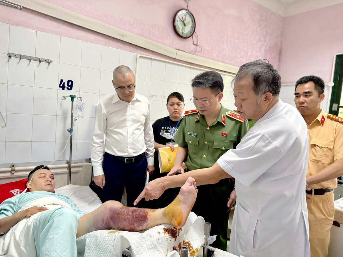 Nam thanh niên đi xe máy "kẹp 3" tông gãy chân CSGT- Ảnh 2.