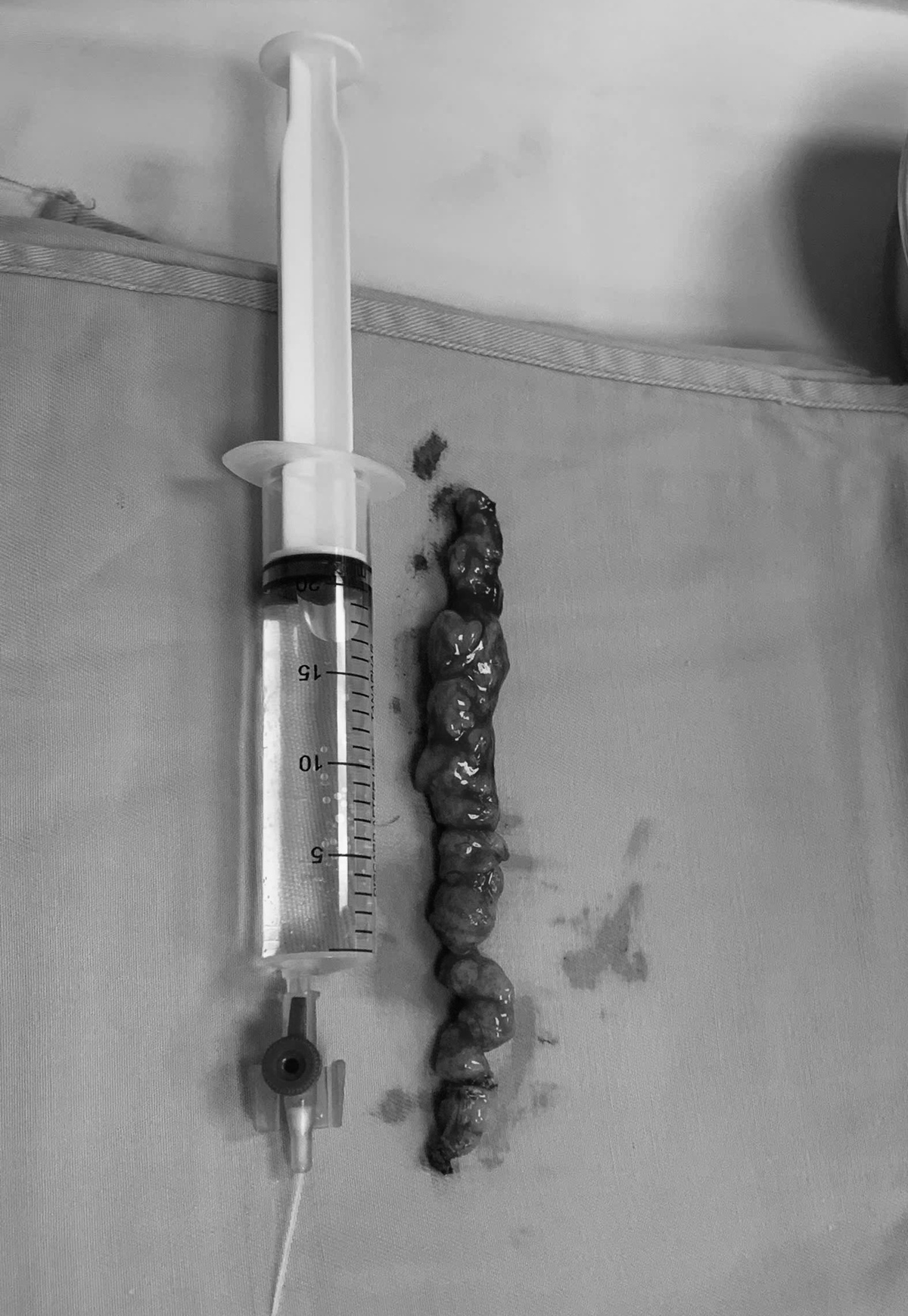 Nữ bệnh nhân 2 lần chiến thắng ung thư- Ảnh 1.