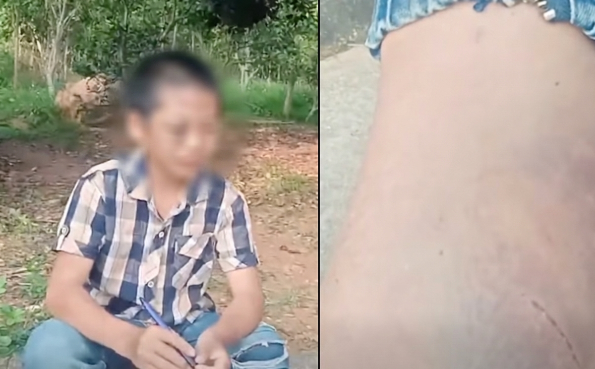 Bé trai lớp 6 đầy vết bầm tím ở Nghệ An: Nghi bị mẹ kế bạo hành nhiều lần- Ảnh 1.