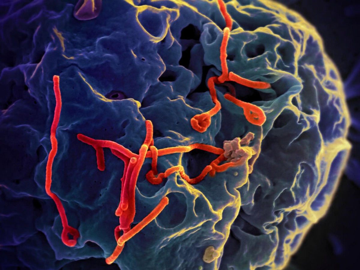4 điểm bất thường khó kiểm soát dịch Ebola- Ảnh 1.