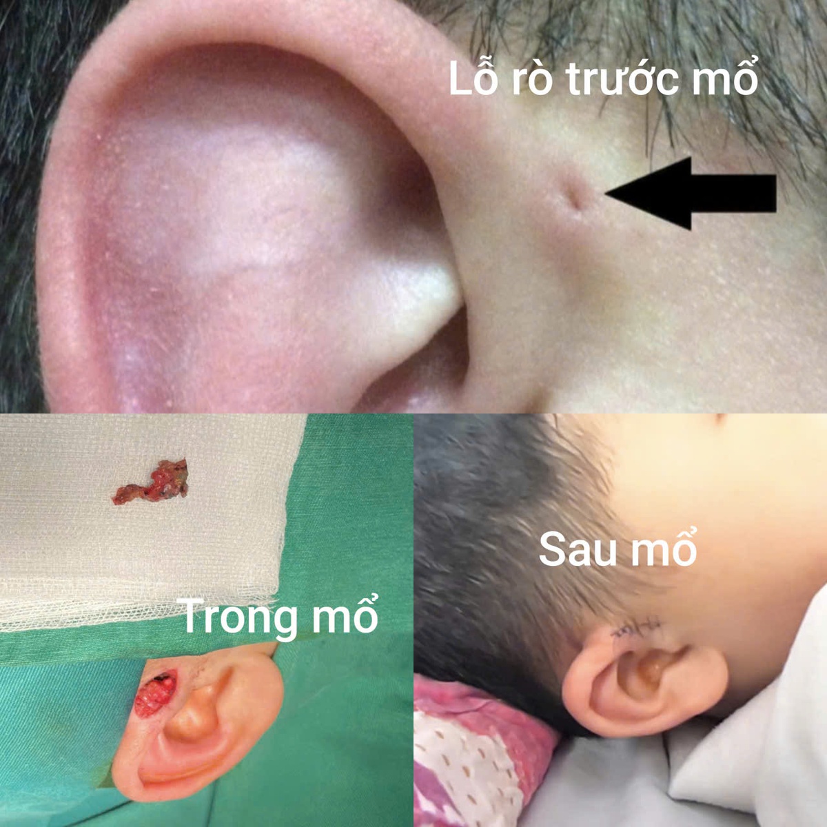 Gia đình 3 thế hệ cùng mắc dị tật- Ảnh 1. Gia đình 3 thế hệ cùng mắc dị tật- Ảnh 1.