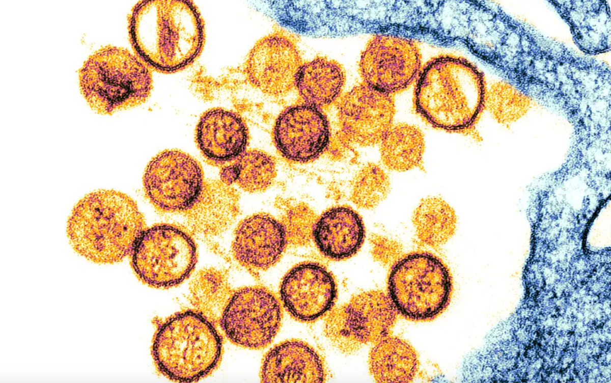 Thế giới virus đang biến đổi khó lường- Ảnh 2. Thế giới virus đang biến đổi khó lường- Ảnh 2.