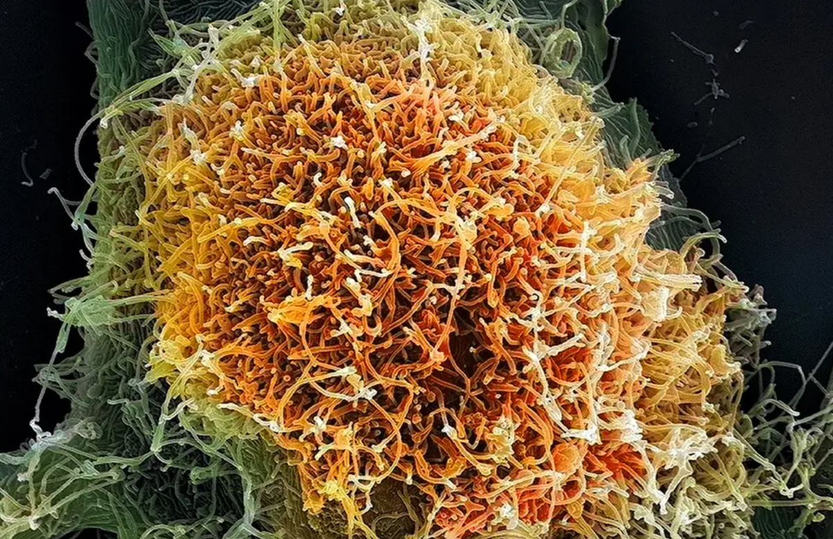 Thế giới virus đang biến đổi khó lường- Ảnh 4. Thế giới virus đang biến đổi khó lường- Ảnh 4.