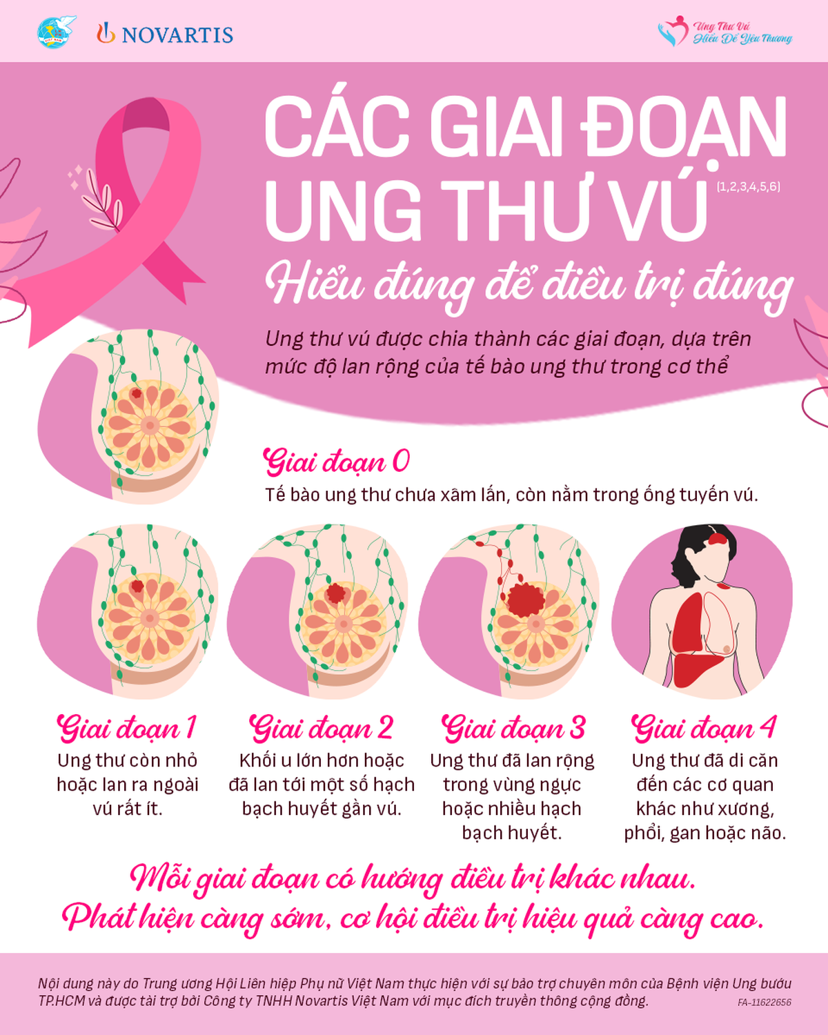 Ung thư vú: Hiểu đúng về các giai đoạn bệnh- Ảnh 1.
