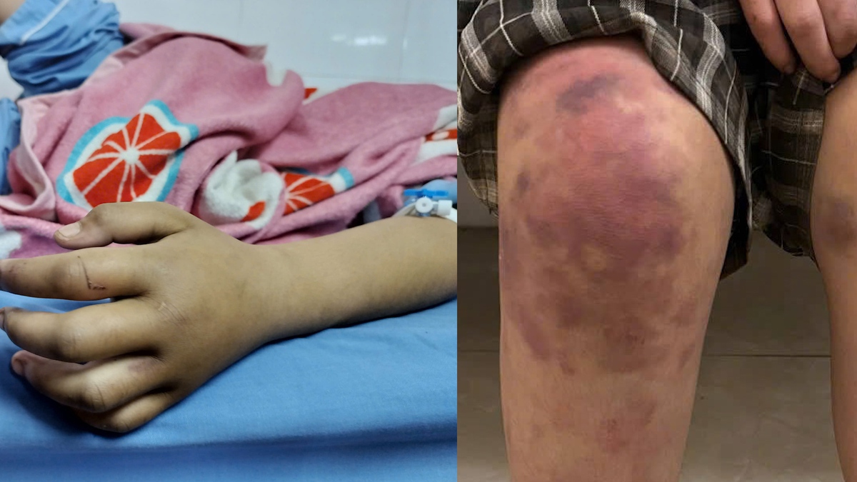 Bộ Y tế: Siết chặt bảo vệ trẻ em, phòng chống bạo lực, xâm hại- Ảnh 1.