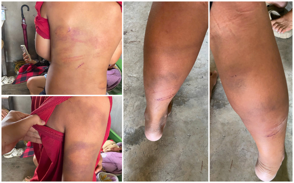 Vụ bé 10 tuổi nghi bị bạo hành ở Nghệ An: Người bà ám ảnh vì sự thay đổi cháu ngoại- Ảnh 2. Vụ bé 10 tuổi nghi bị bạo hành ở Nghệ An: Người bà ám ảnh vì sự thay đổi cháu ngoại- Ảnh 2.
