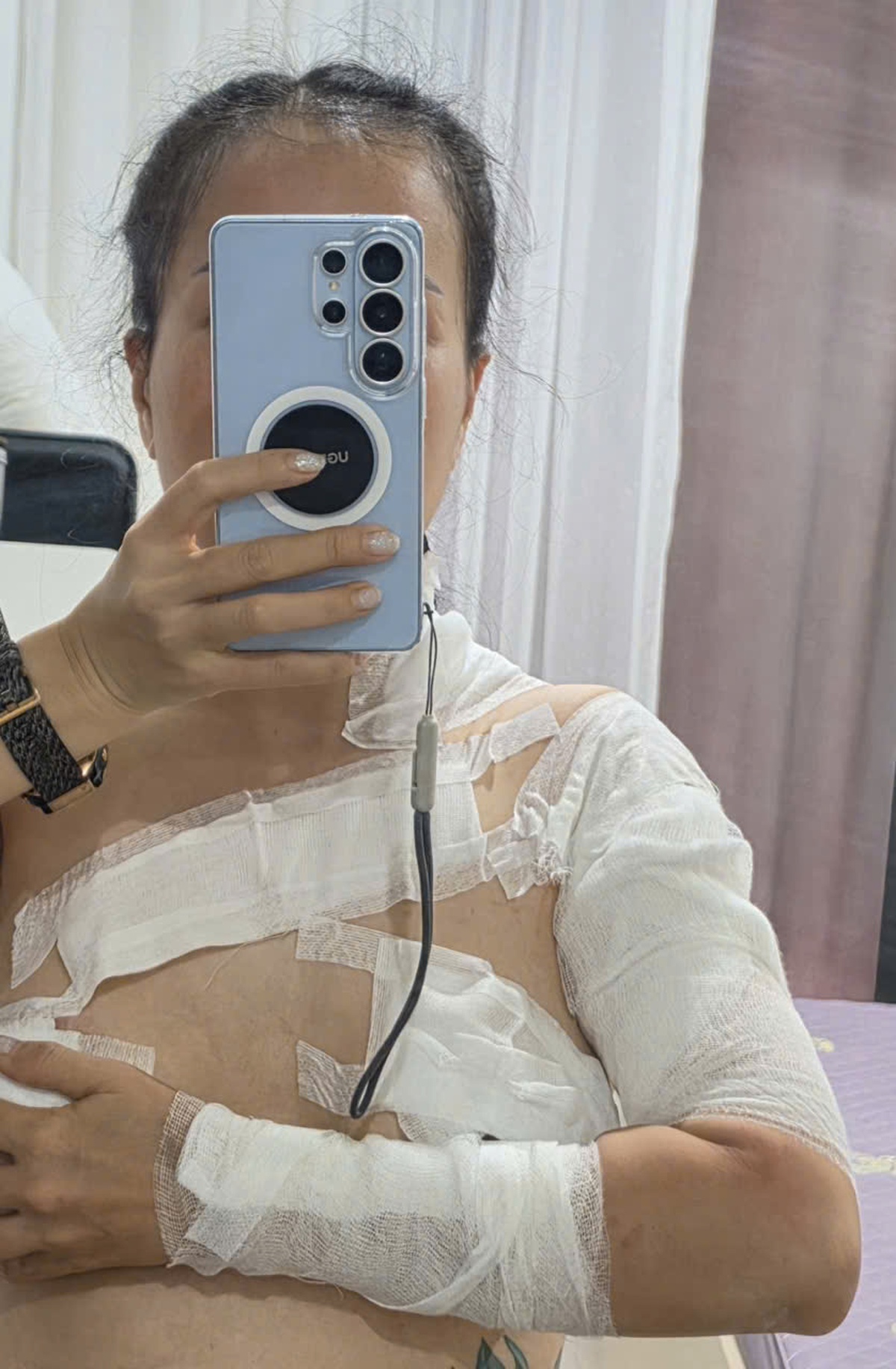 Người phụ nữ tố bị bỏng khi sử dụng dịch vụ tại spa ở Hà Nội- Ảnh 1.