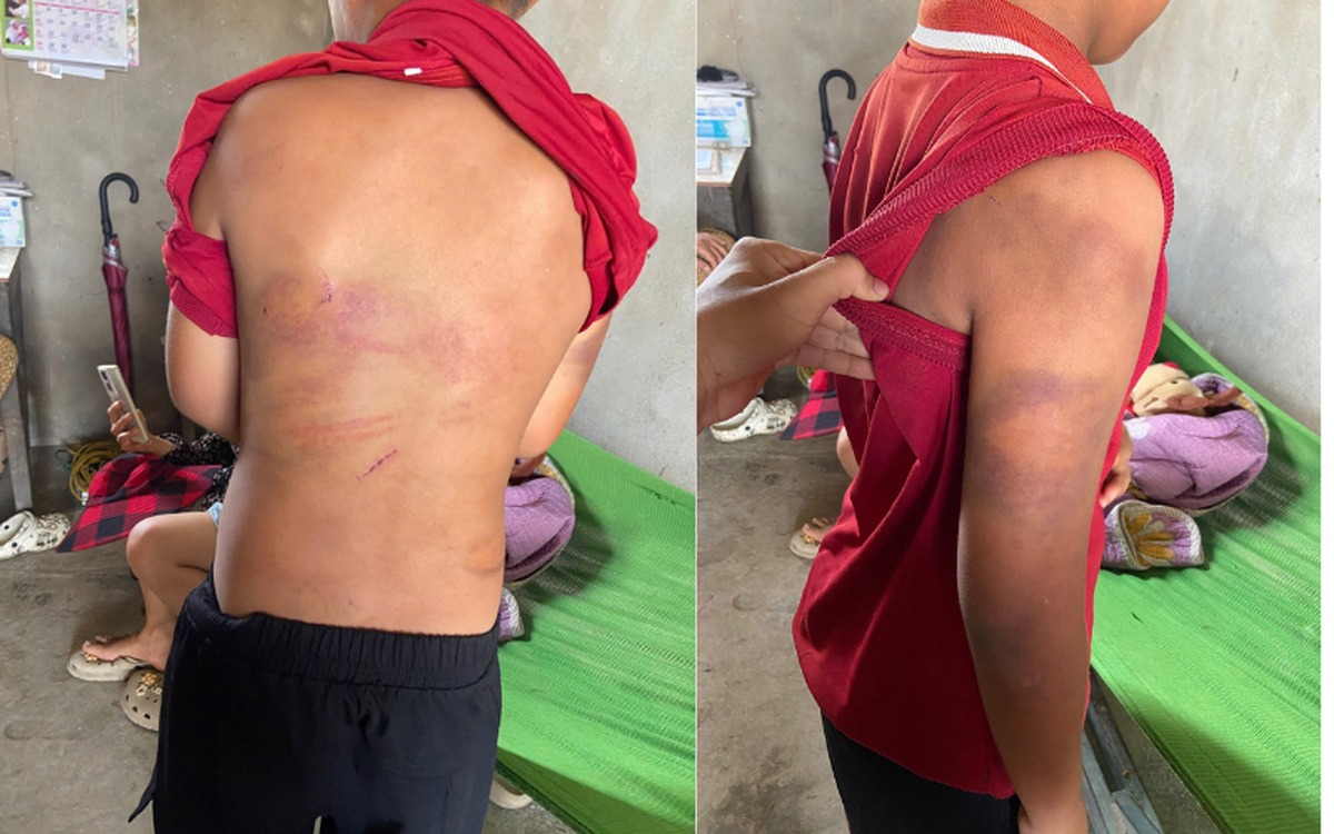 Vụ bé trai ở Nghệ An nghi bị bạo hành: Tòa giao con cho mẹ tại phiên sơ thẩm - Ảnh 1.