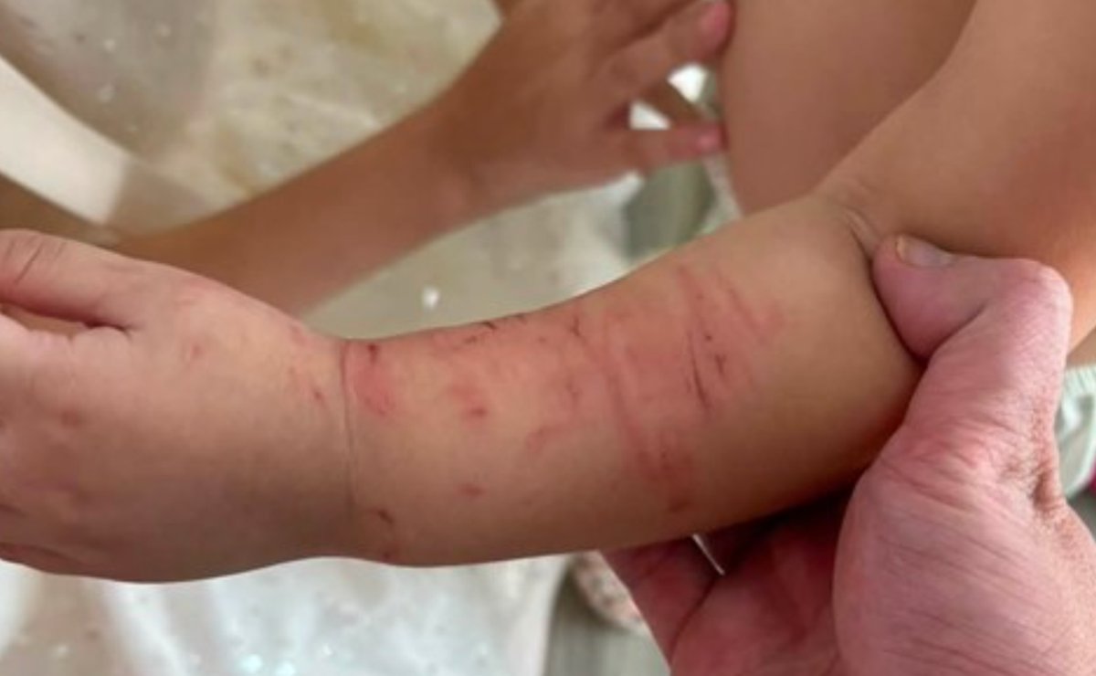 Khánh Hòa: Chính quyền vào cuộc vụ bé mầm non bị cào xước nhiều nơi trên cơ thể - Ảnh 1.