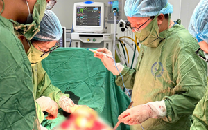 Giành giật sự sống cho sản phụ có khối u xơ kích thước lớn hơn 1kg  