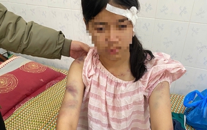 Hé lộ nguyên nhân vụ bé gái 13 tuổi bị ông bà bạo hành ở Thái Nguyên