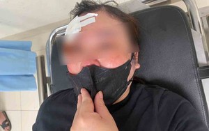 Công an vào cuộc vụ người phụ nữ tố bị tài xế ô tô dùng dùi cui vụt vào đầu