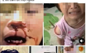 Vụ bé gái nghi bị bố bạo hành, bắt gọi mẹ 